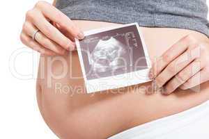 Pregnant woman displaying a prenatal ultrasound