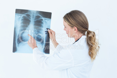 Focused doctor looking at xray