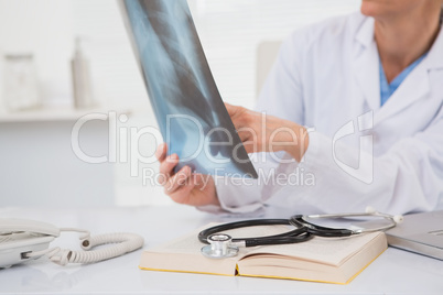 Doctor analysing xray results