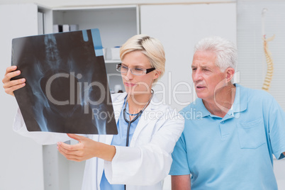 Doctor and senior patient examining x-ray