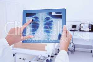 Composite image of doctor looking at xray on tablet