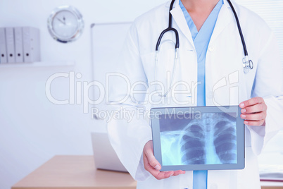 Composite image of doctor looking at xray on tablet