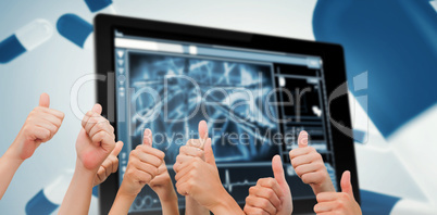 Composite image of group of hands giving thumbs up