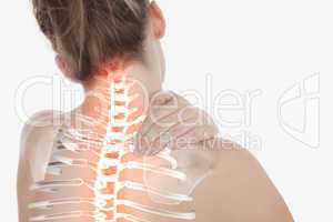 Highlighted spine of woman with neck pain
