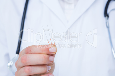 Doctor holding acupuncture needles