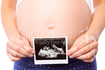 Pregnant woman showing ultrasound scans