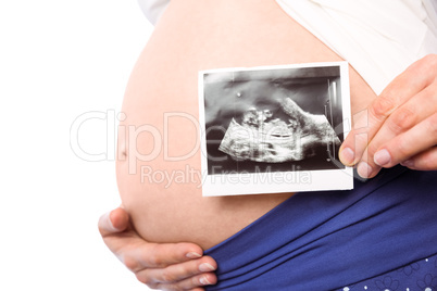 Pregnant woman showing ultrasound scans