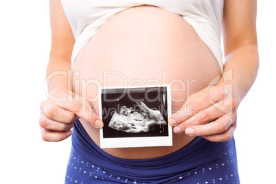 Pregnant woman showing ultrasound scans