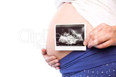 Pregnant woman showing ultrasound scans