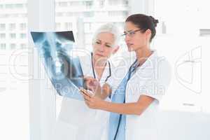 female doctors examining x-ray