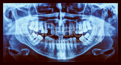 Retro look Medical Xray