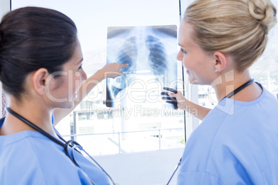 Doctors looking at Xray