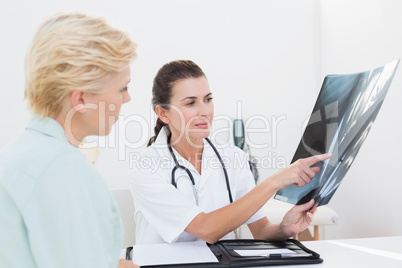 Doctor showing Xray to her patient