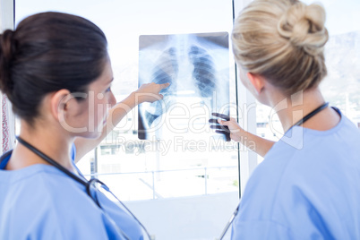 Doctors looking at Xray