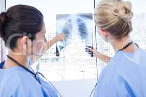 Doctors looking at Xray