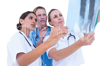 Doctors and nurses looking at x-ray