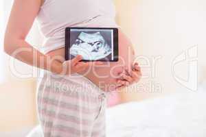 Pregnant woman showing ultrasound scans