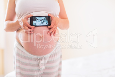 Pregnant woman showing ultrasound scans