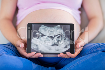 Pregnant woman showing ultrasound scans