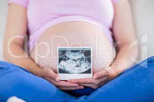 Pregnant woman showing ultrasound scans