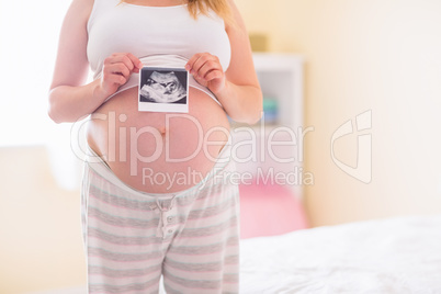 Pregnant woman showing ultrasound scans