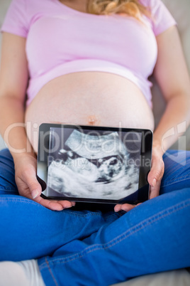 Pregnant woman showing ultrasound scans