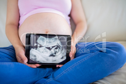 Pregnant woman showing ultrasound scans