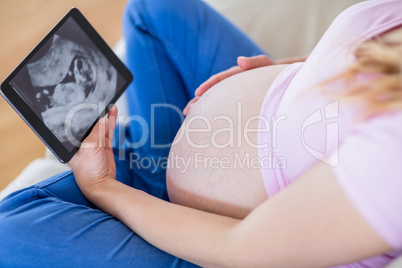 Pregnant woman looking at ultrasound scans and touching her bell