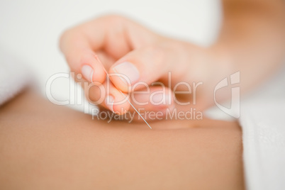 Woman holding a needle in an acupuncture therapy