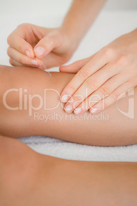 Woman holding a needle in an acupuncture therapy