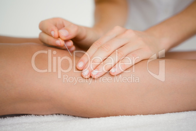 Woman holding a needle in an acupuncture therapy