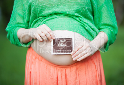Pregnant woman with ultrasound image of a baby