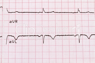 Cardiogram on paper