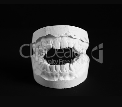 Dental Mold