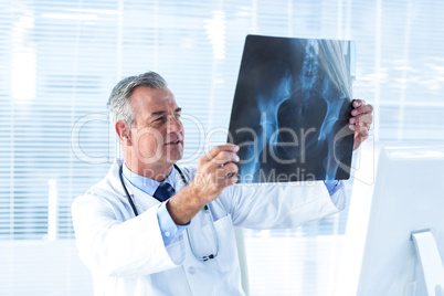 Male doctor reviewing X-ray in hospital