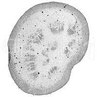 Black and white Mulberry micrograph