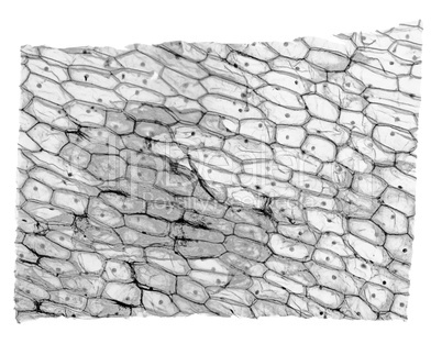Black and white Onion epidermus micrograph
