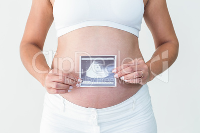 Pregnant woman showing an ultrasound scan Pregnant woman showing an ultrasound scan