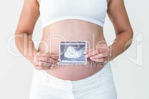 Pregnant woman showing an ultrasound scan