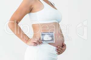 Pregnant woman holding an ultrasound scan