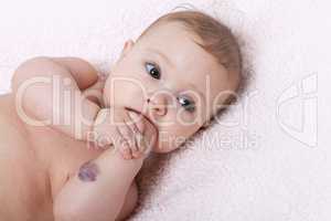 Cute baby girl with hemangioma on her arm