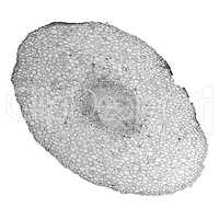 Black and white Vicia faba root micrograph