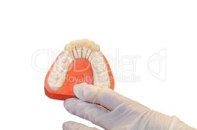 Zahnersatz, Prothese