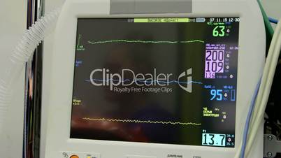 Screen of Russian multiparameter patient monitor in ambulance or hospital