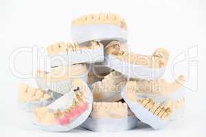 plaster model of teeth
