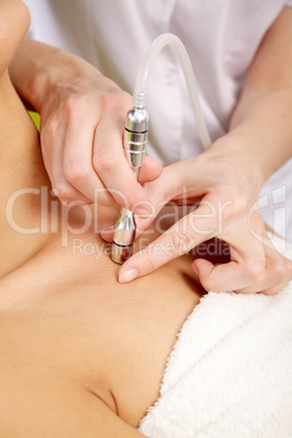 Young woman receiving laser therapy