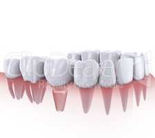 teeth and implant