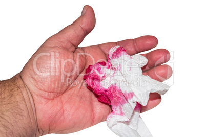 Verletzte Hand mit einem blutigen Taschentuch