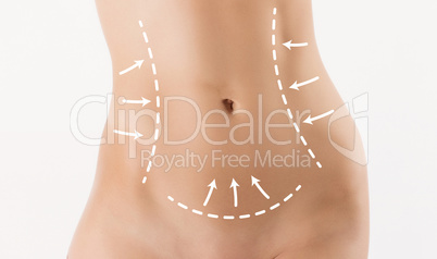 Body correction with the help of plastic surgery on white background