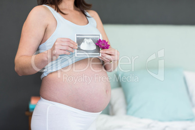 Pregnant woman holding an ultrasound scan